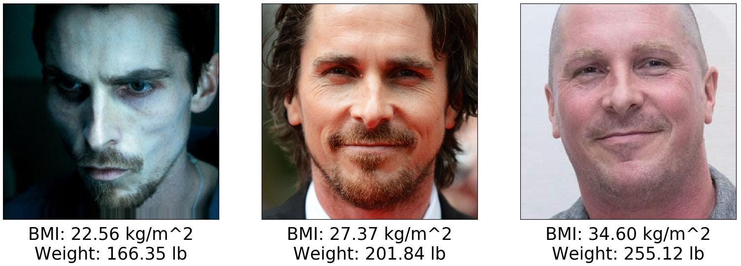 Estimating Body Mass Index From Face Images Using Keras And