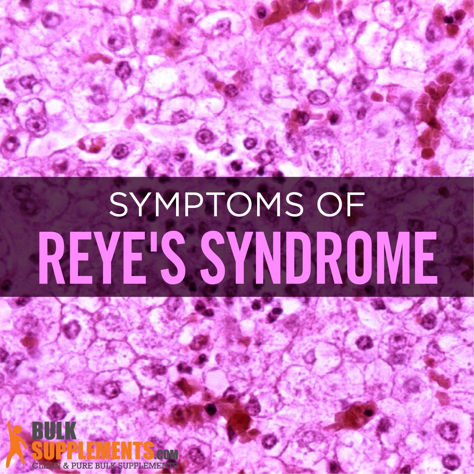Reye’s Syndrome Causes, Symptoms & Treatment by James Denlinger Medium