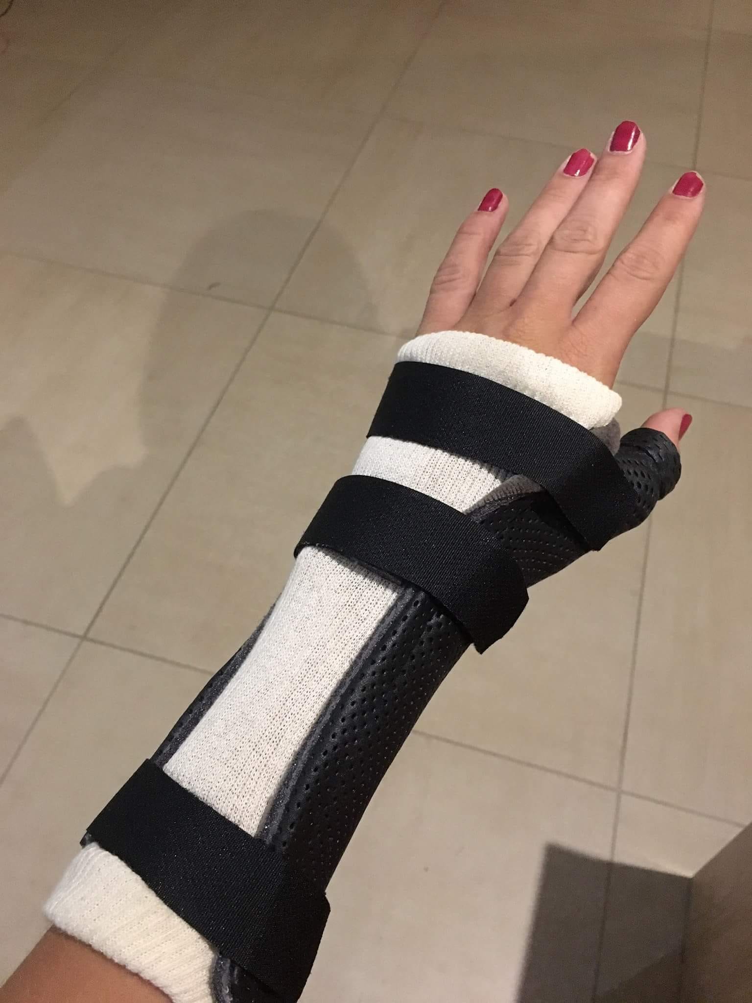 How to survive a broken wrist. About 10 days ago, I broke