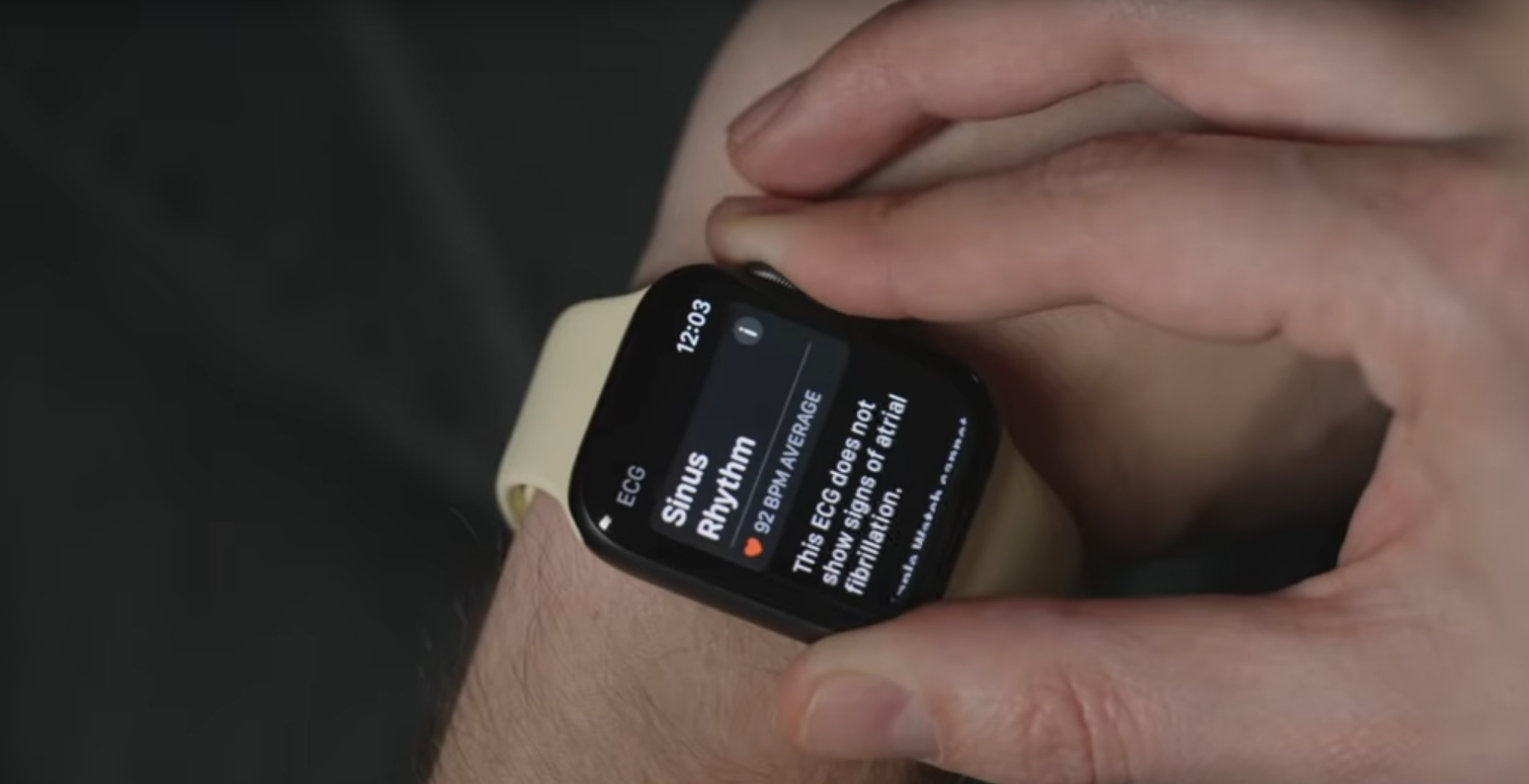 android smartwatch you can text and call on
