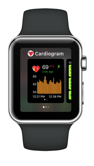 apple watch series 4 cardiogram
