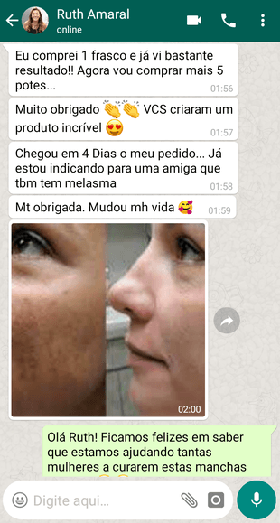 phytopeel para melasma