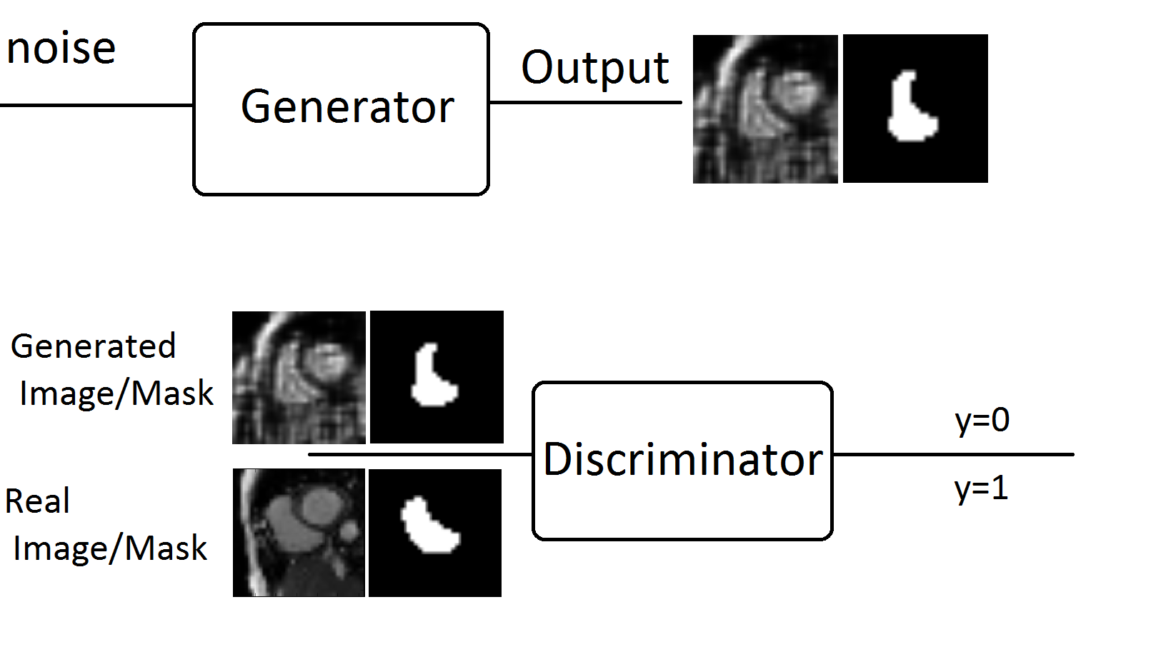 GAN for Medical Imaging Generating Images and Annotations