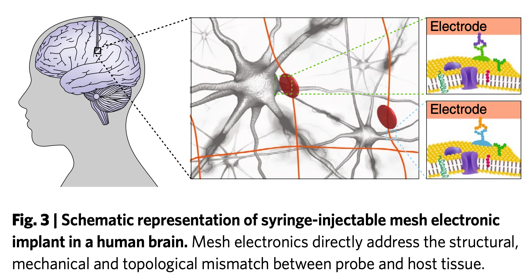 The BrainMachine Interface & Syringeinjectable Mesh