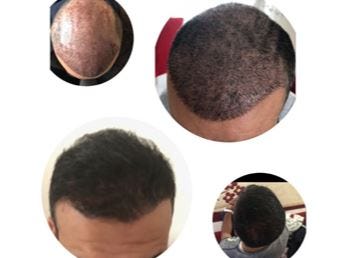 How To Get Hair Back Nancy Medium