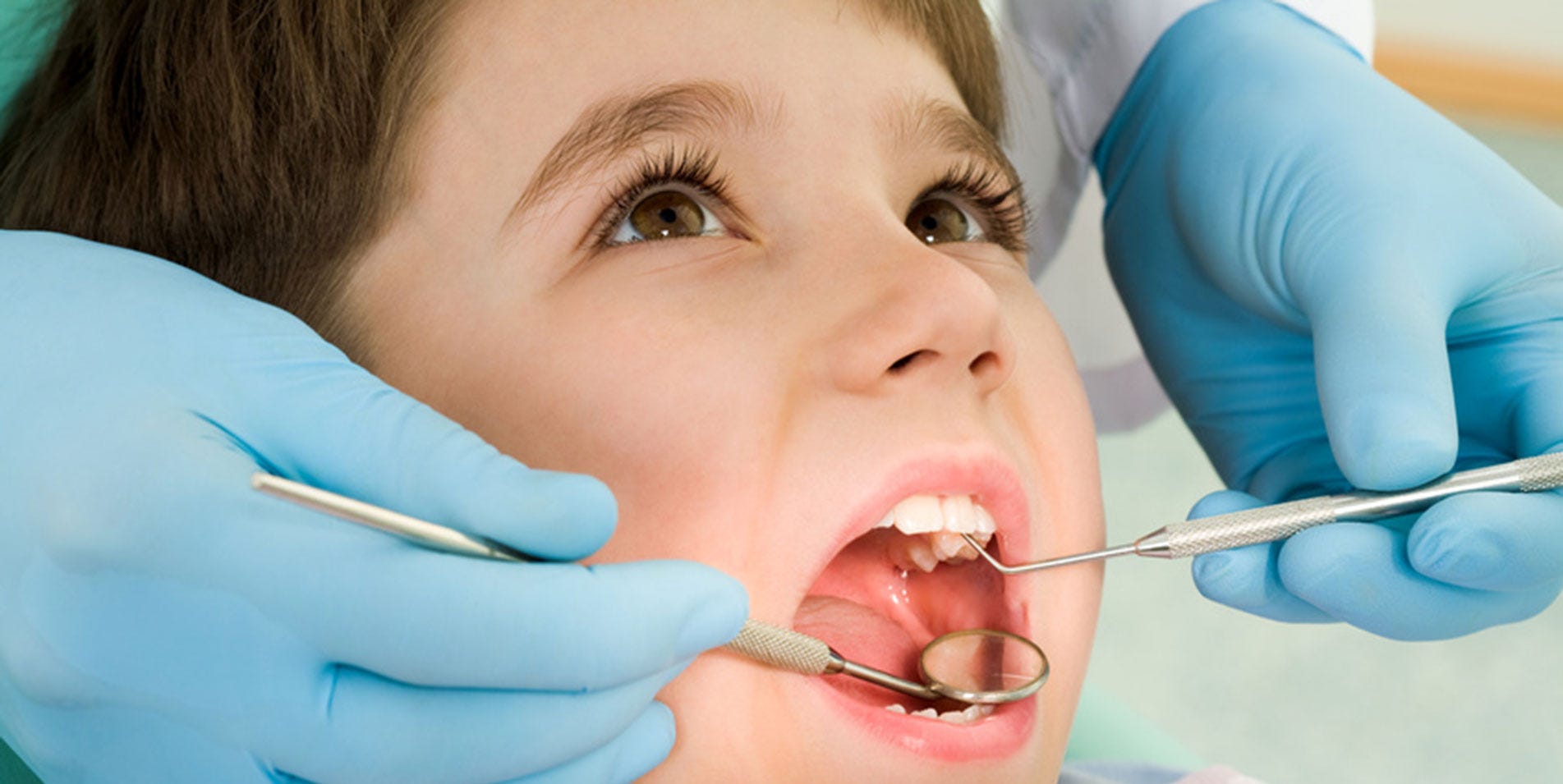 How long do fillings take for Tooth Cavities? | by Discover Smiles Dental | Feb, 2021 | Medium How long do fillings take for Tooth Cavities? | by Discover Smiles Dental | Feb, 2021 | Medium