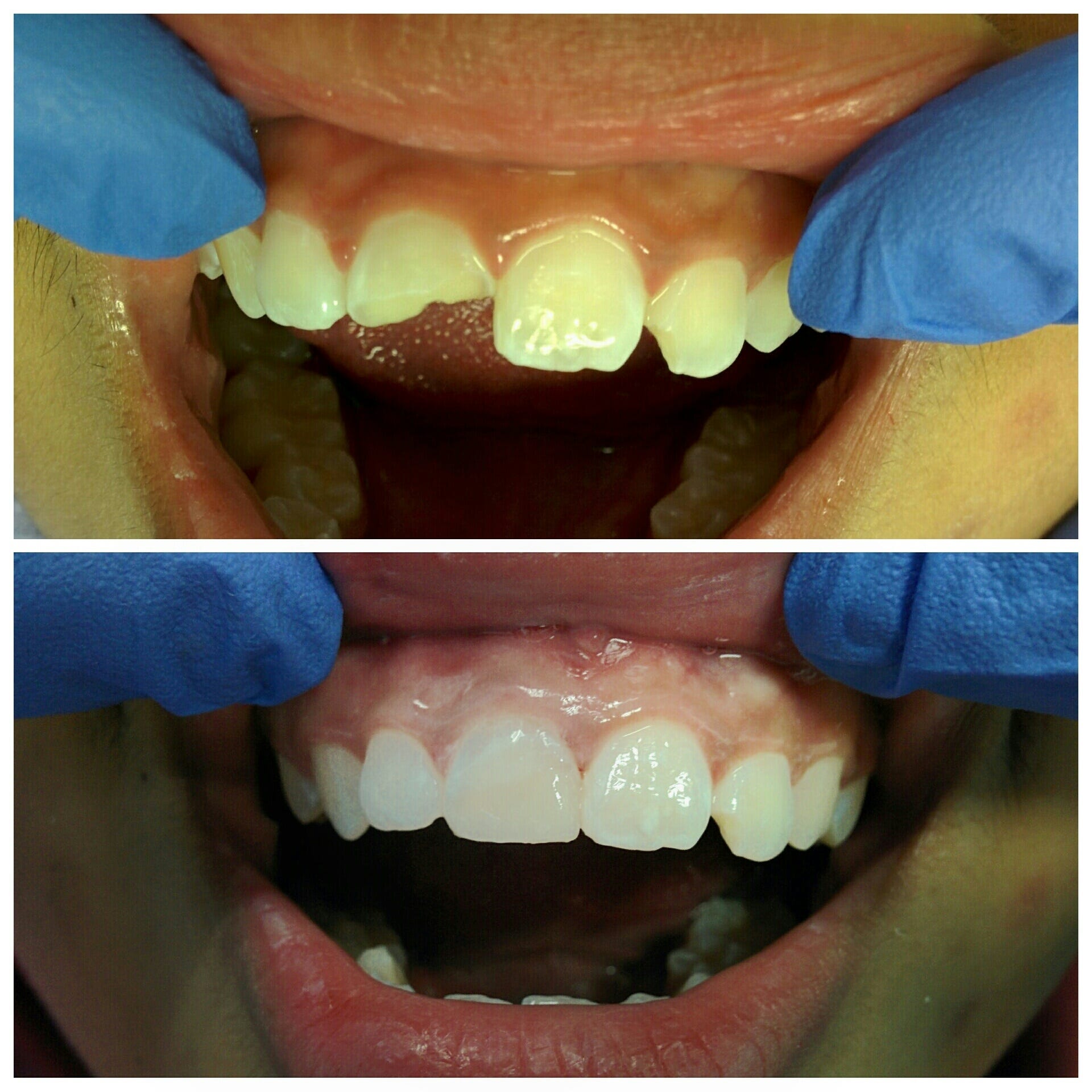 57 SCALING TEETH MALAYSIA PRICE ScalingTeeth