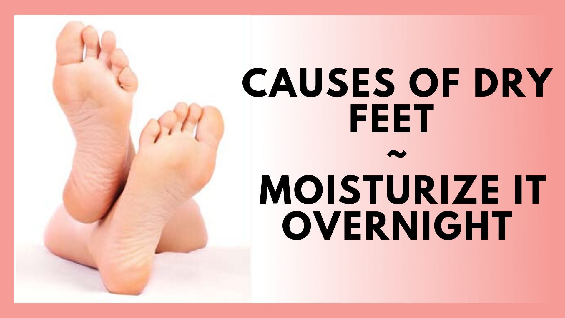 very dry feet causes