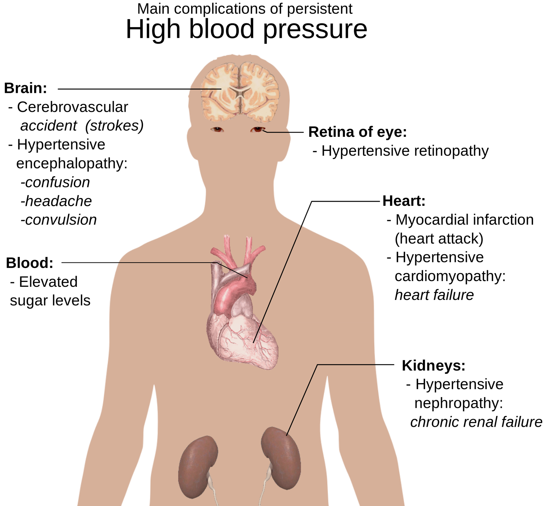 what causes high blood pressure