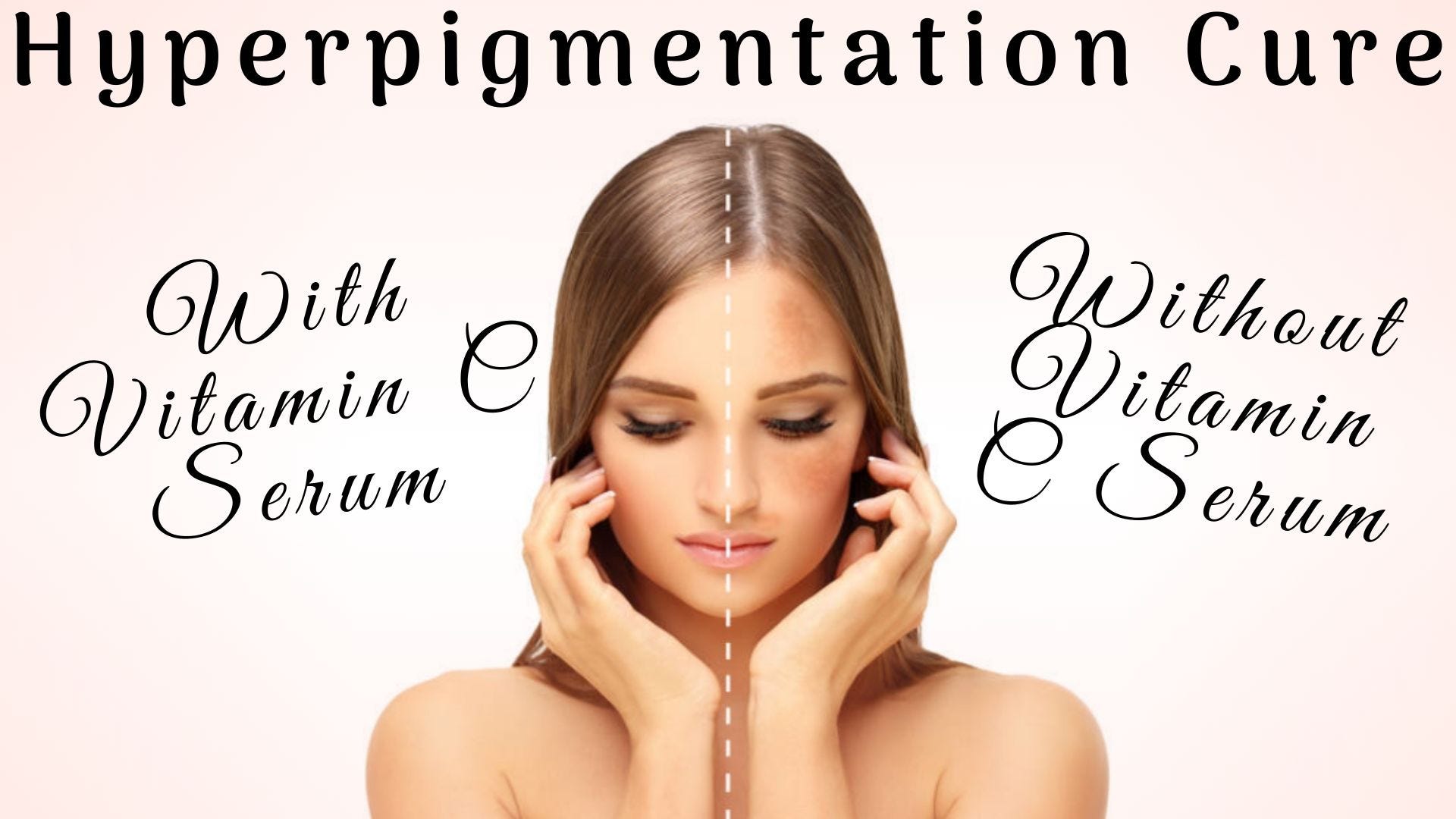 vitamin c for pigmentation