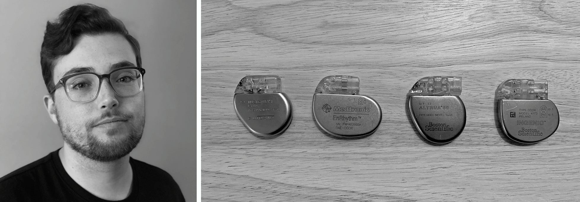 Two photos side-by-side: The author; The author’s previous cardiac devices.