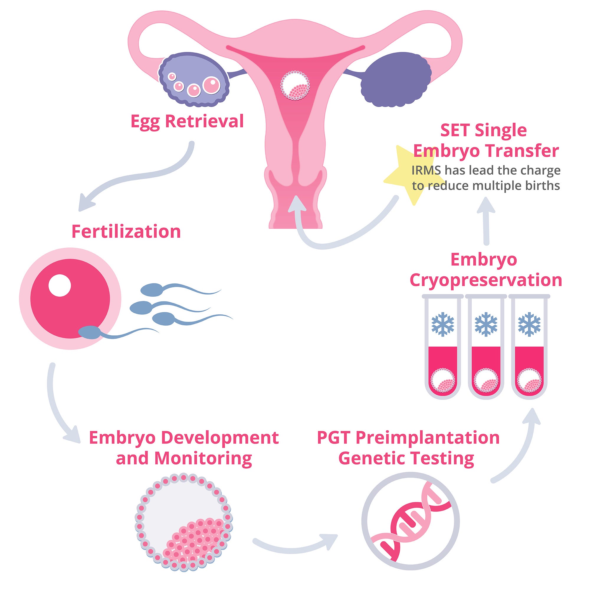 How Long Does IVF Take? An Overview of the IVF Process
