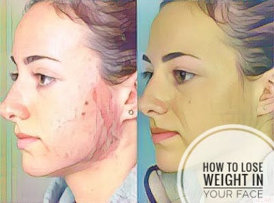 how to lose weight from ur face