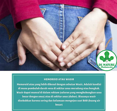 Obat Paling Ampuh Untuk Benjolan Di Dubur Yang Keluar Waktu