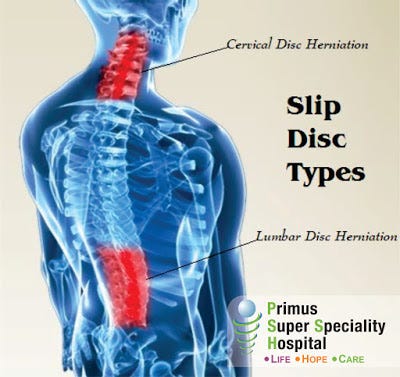 Disc symptoms slip Slipped disc