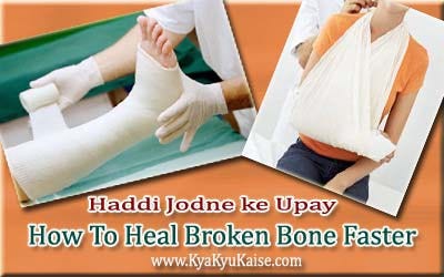 Tuti Haddi Jodne Ke Upay Bone Fracture Treatment In Hindi