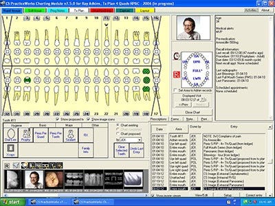 Eaglesoft Dental Charting