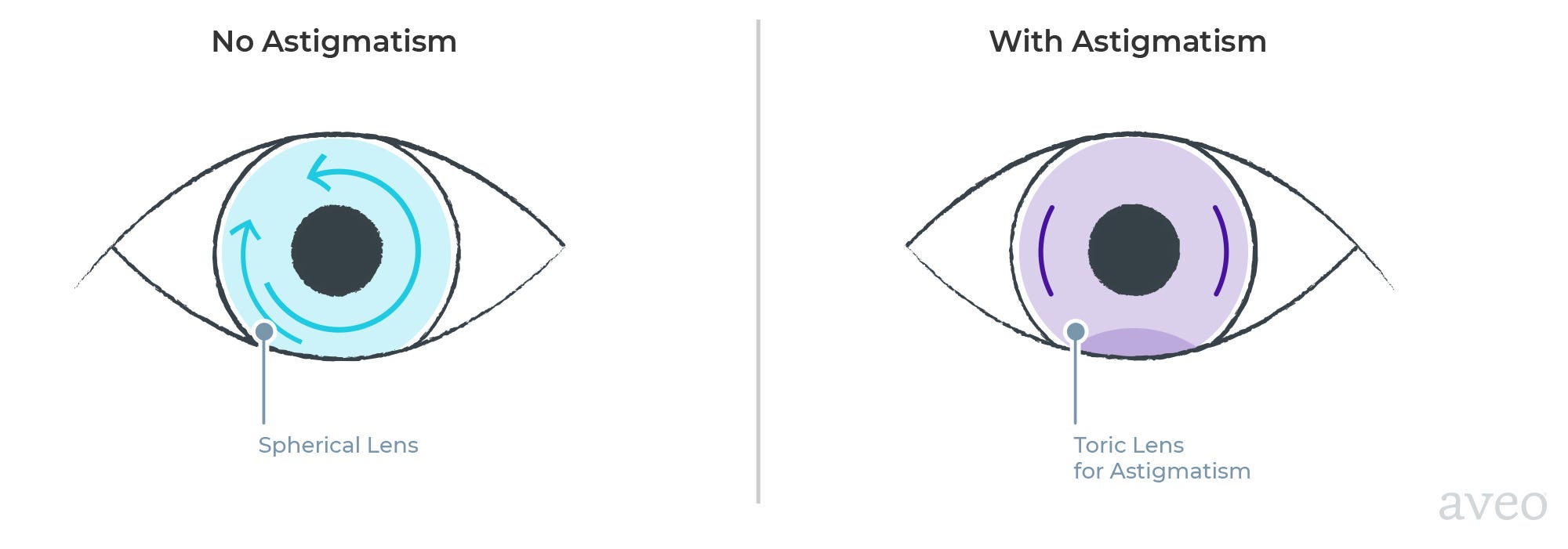 Contact Lenses For Astigmatism / ACUVUE OASYS® for ASTIGMATISM 2-Week Contact Lenses / They are designed specifically for people who have astigmatism.