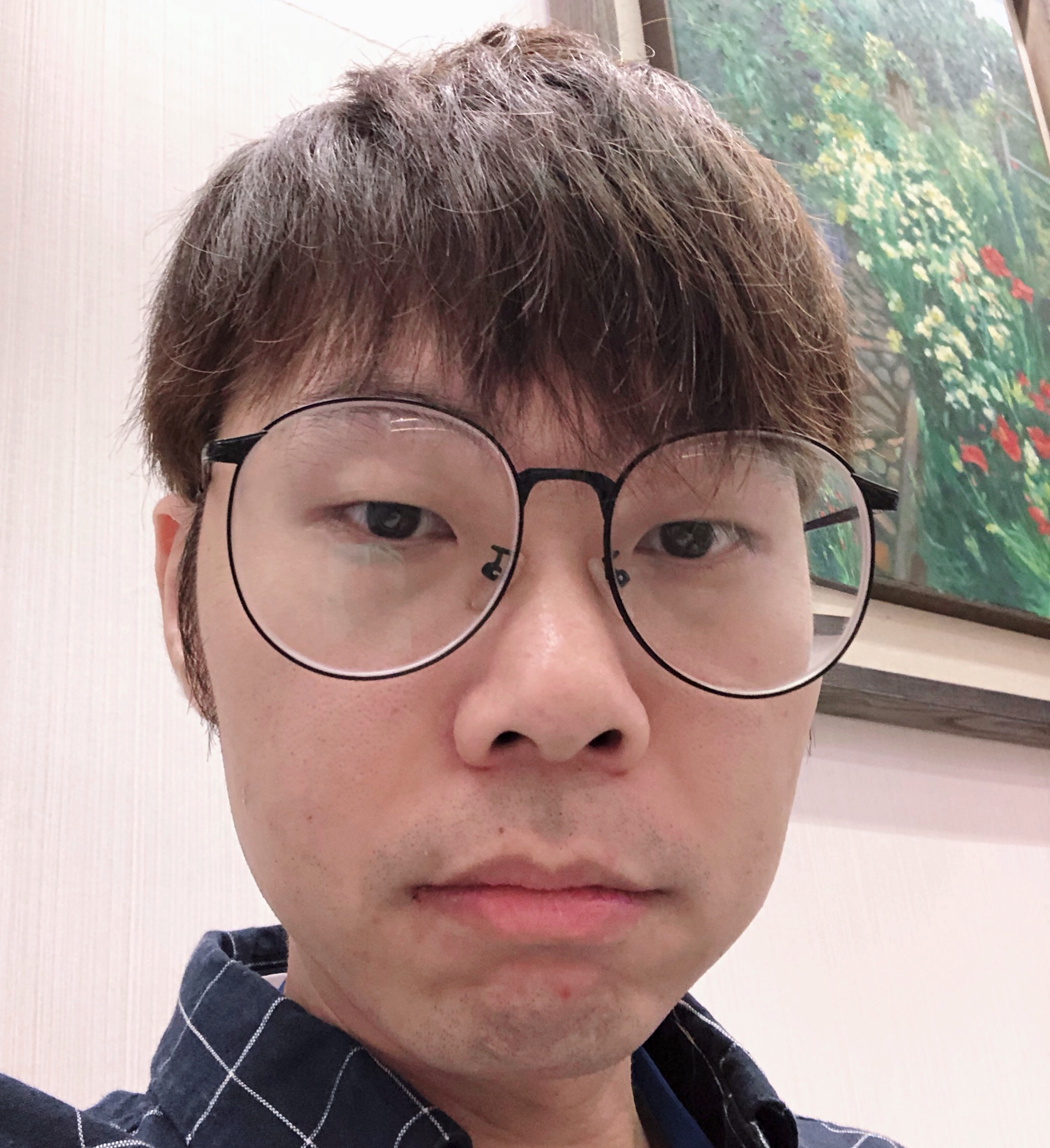 姆斯の日常 終於不用戴眼鏡了 近視雷射手術其實不怎麼恐怖 By James Yu Medium