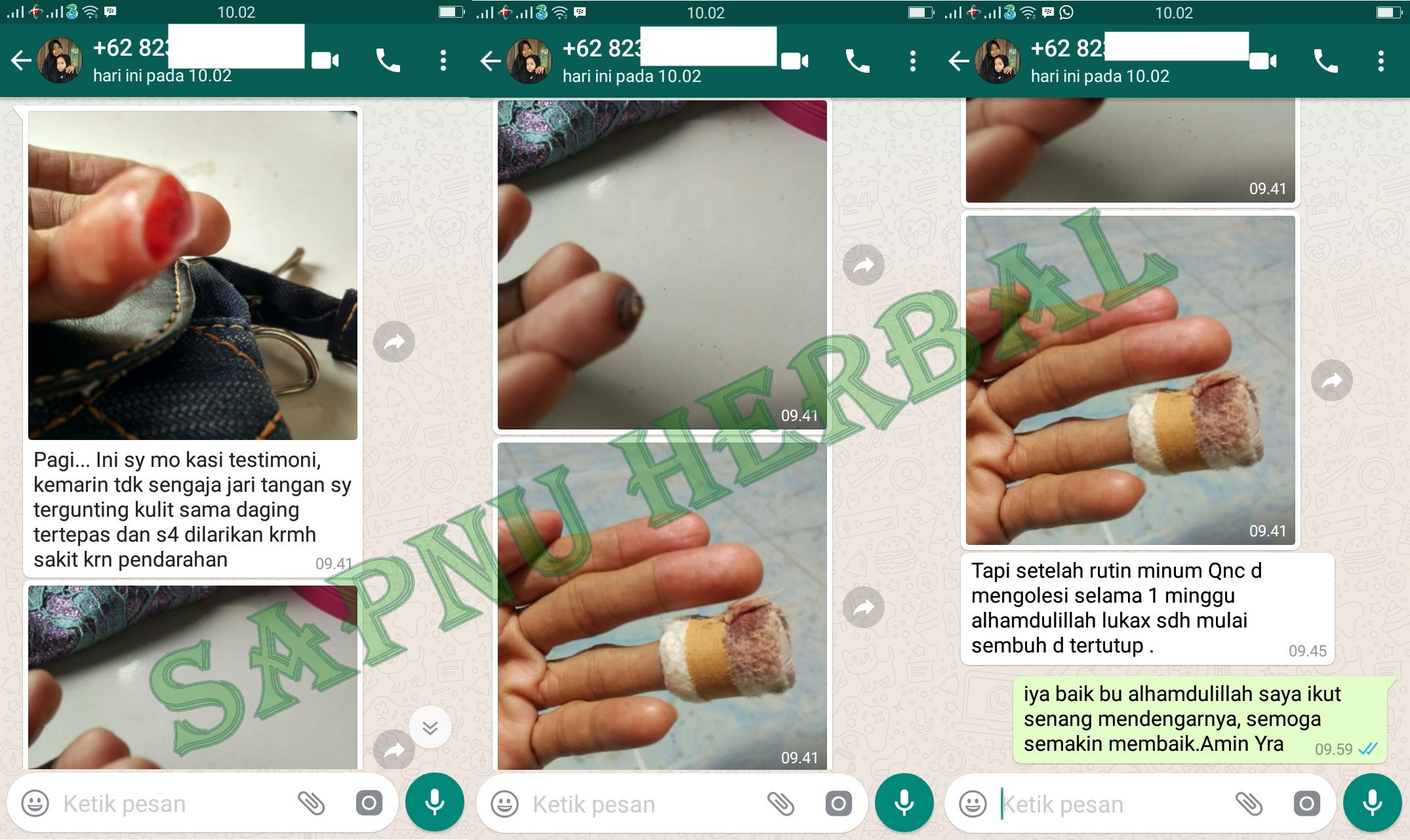 Obat Penyembuhan Diabetes Melitus Obat Penyembuhan Obat Penyembuhan Diabetes Melitus Obat Penyembuhan