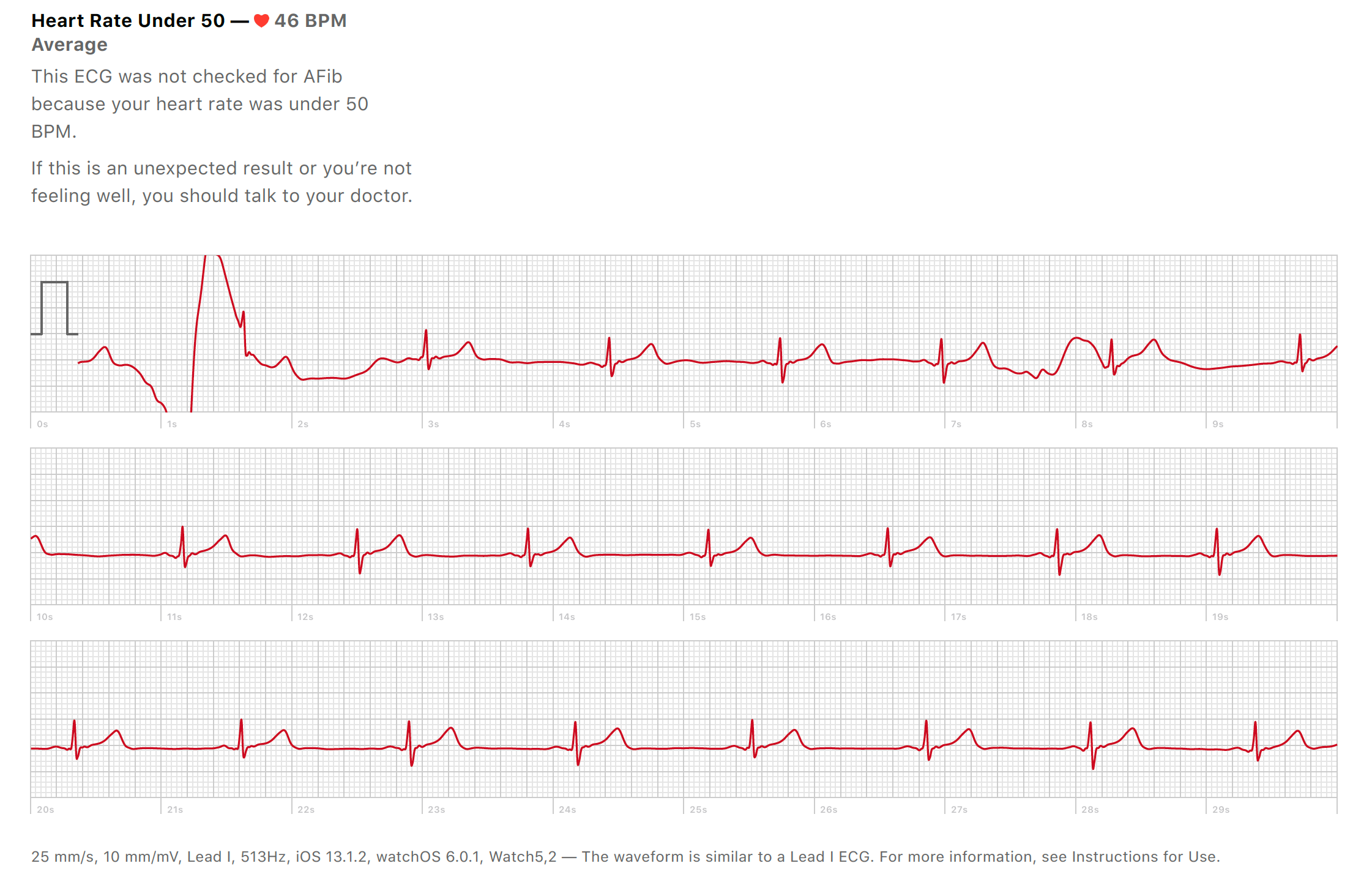 ecg reading apple watch