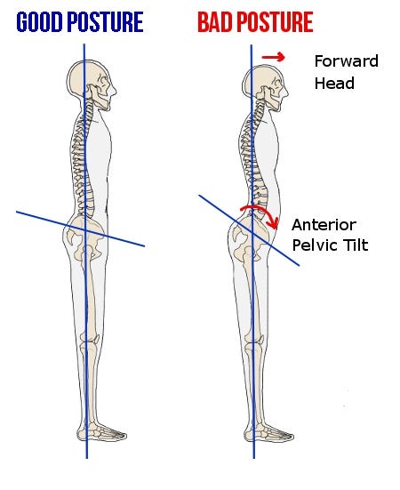 How I Fixed my Anterior Pelvic Tilt (APT) | by Ronald Leite | Medium