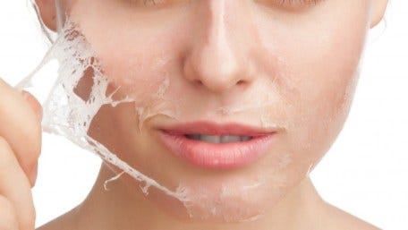 face peeling treatment
