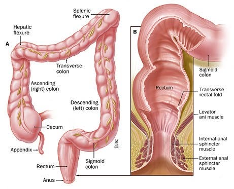 Rectal prolapse is when portion of the rectum obtrudes from the anus