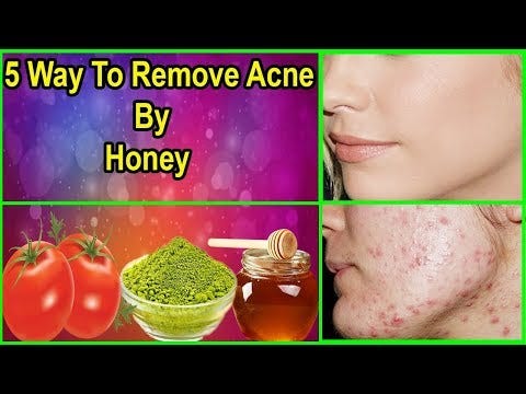 homemade acne treatment