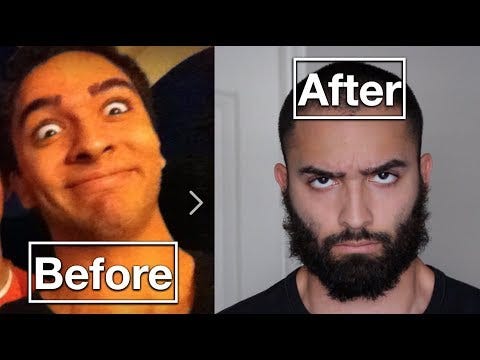 Nofap hair growth