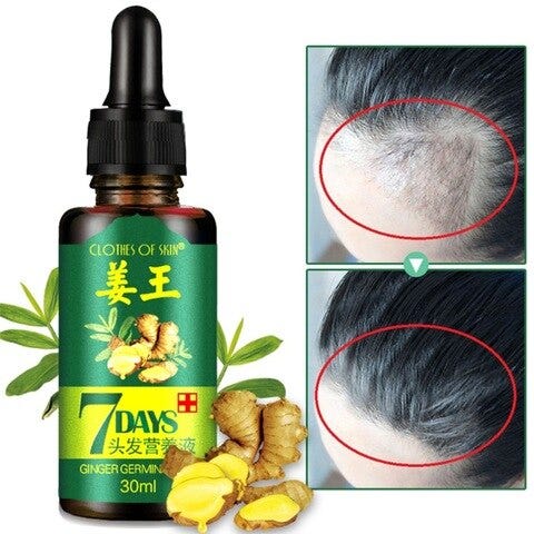30ml Hair Loss Treatment Ginger Hair Care Growth Essence Oil For