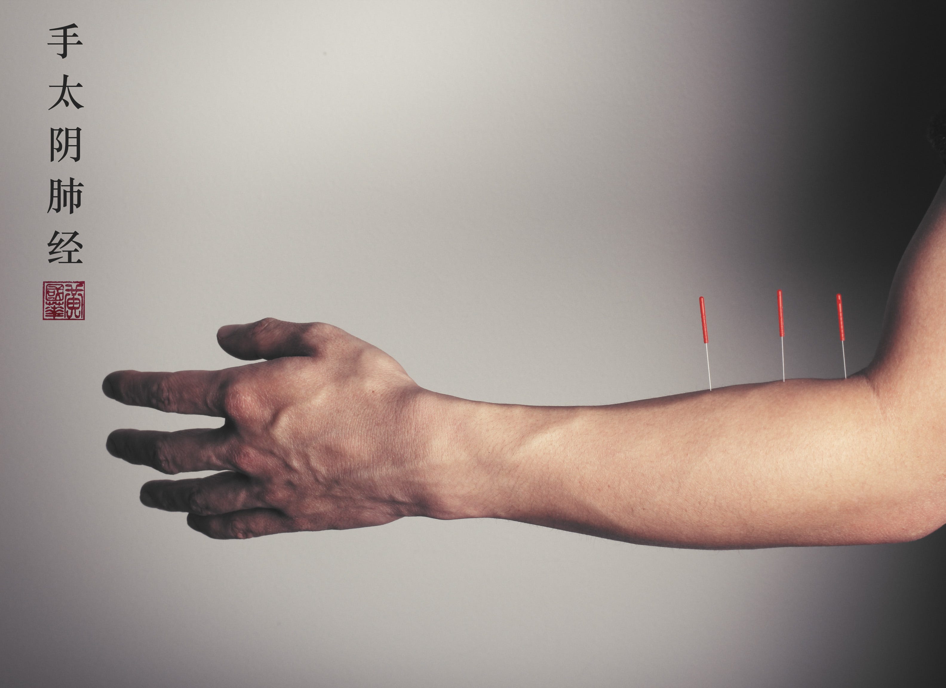 Top 5 Back Pain Acu-Points. go-to points for lower back pain | by Art of Acupuncture | Medium Top 5 Back Pain Acu-Points. go-to points for lower back pain | by Art of Acupuncture | Medium