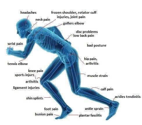 Various Musculoskeletal conditions that you can get physiotherapy | by ...