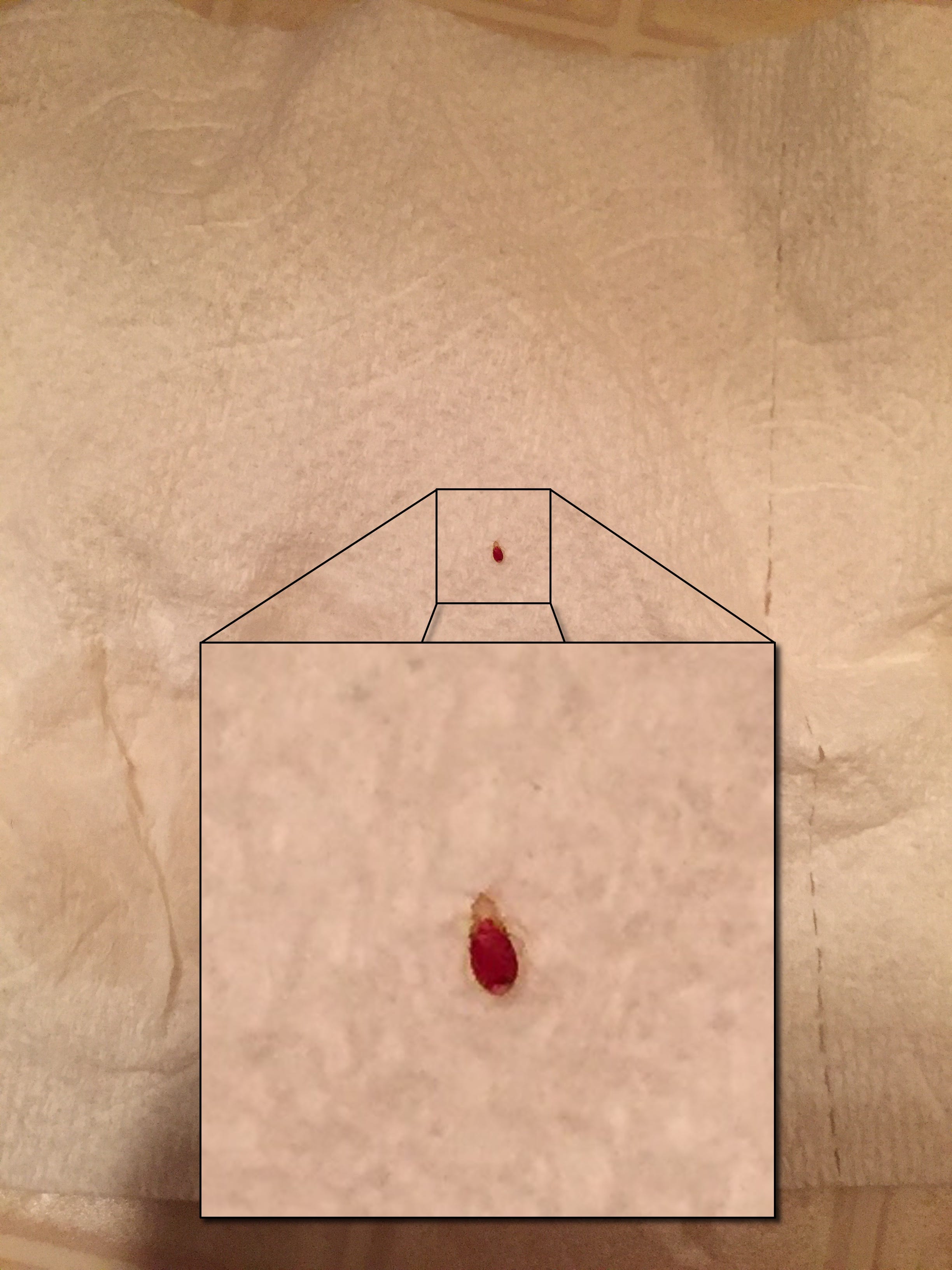 Imaginary Bugs And How To Eliminate Them Jack Herlocker Medium