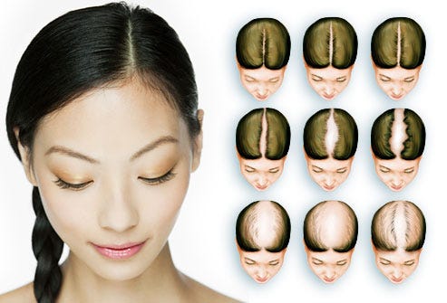 What Can Cause Female Hair Loss Aanaya Khan Medium