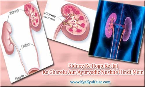 Kidney Rogo Ka Ilaj Aur Upay Ke Ayurvedic Nuskhe Hindi Mein By Govind Medium