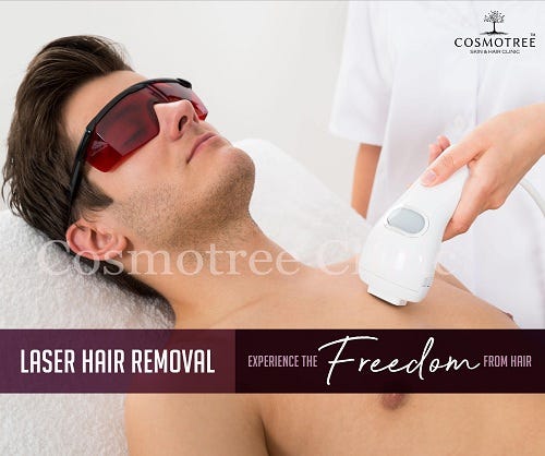 laser hair removal options