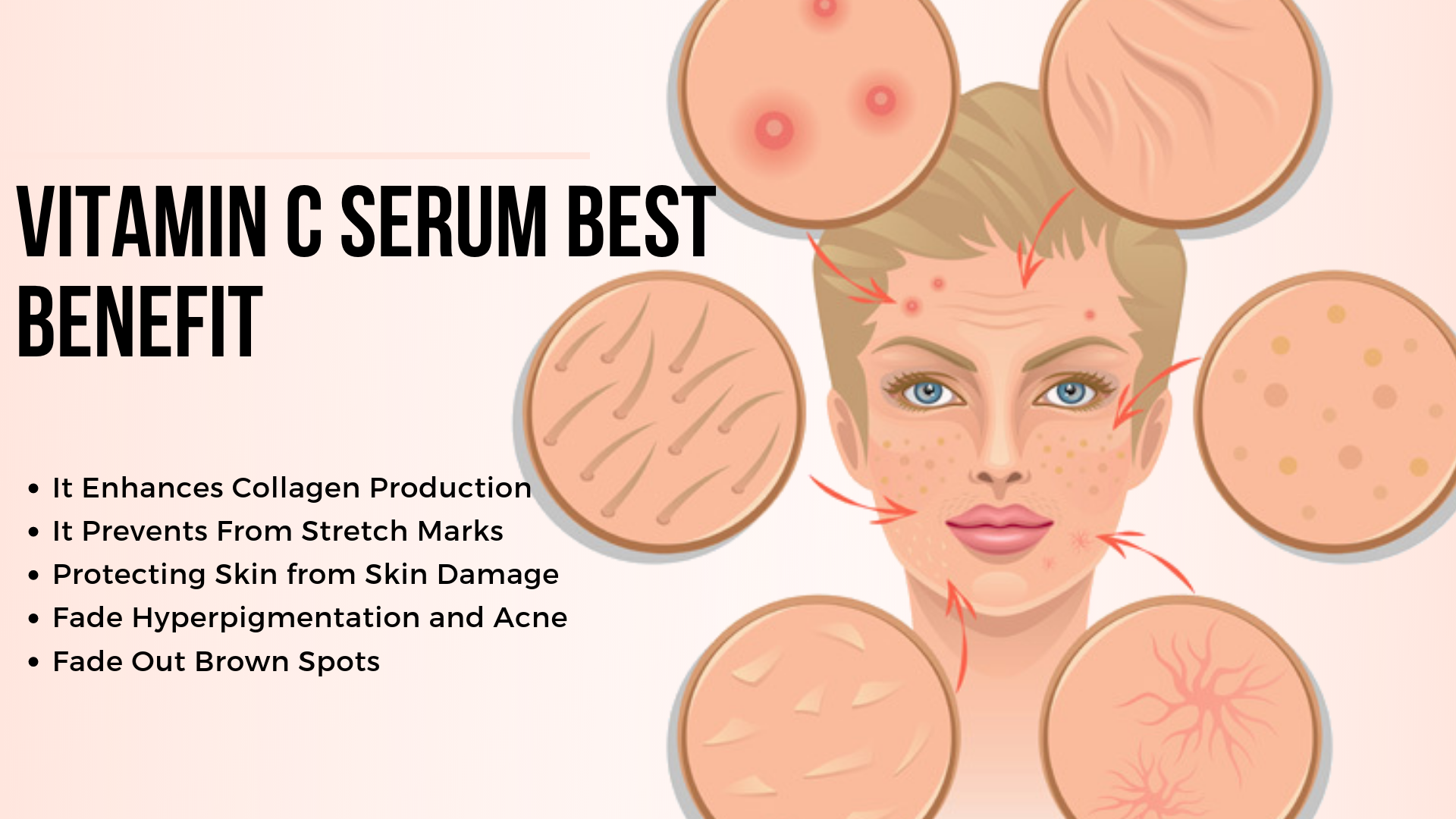 best vitamin c for hyperpigmentation