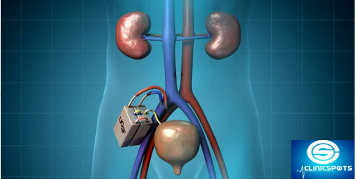Artificial Kidney Transplant May Hit The Indian Market By 2020 By Garima Dang Medium