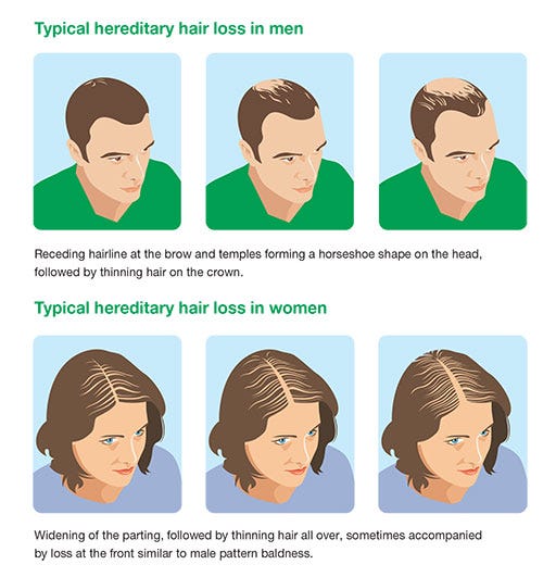 what is reversible hair loss