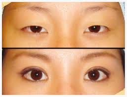 beauty is in the (right) eye of the beholder | by Joyce J | Medium beauty is in the (right) eye of the beholder | by Joyce J | Medium