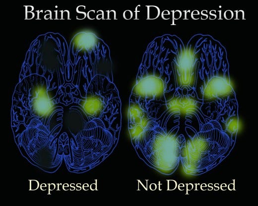 Path-of-what-is(iology) Depression - Healthy Communities Weekly ...