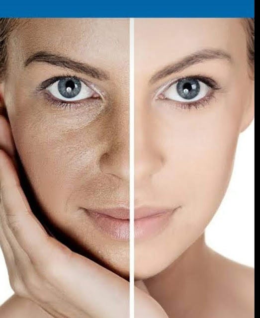 clear skin naturally