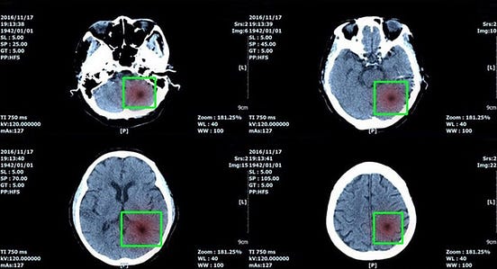What is Medical Image Annotation: Role in AI Medical Diagnostics