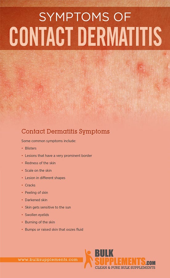 Contact Dermatitis Symptoms, Causes & Treatment