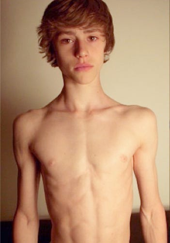 David Laid 3 Year Natural Transformation 14 17