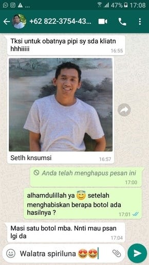 Vitamin Penambah Nafsu Makan Untuk Dewasa Di Apotik | by ...