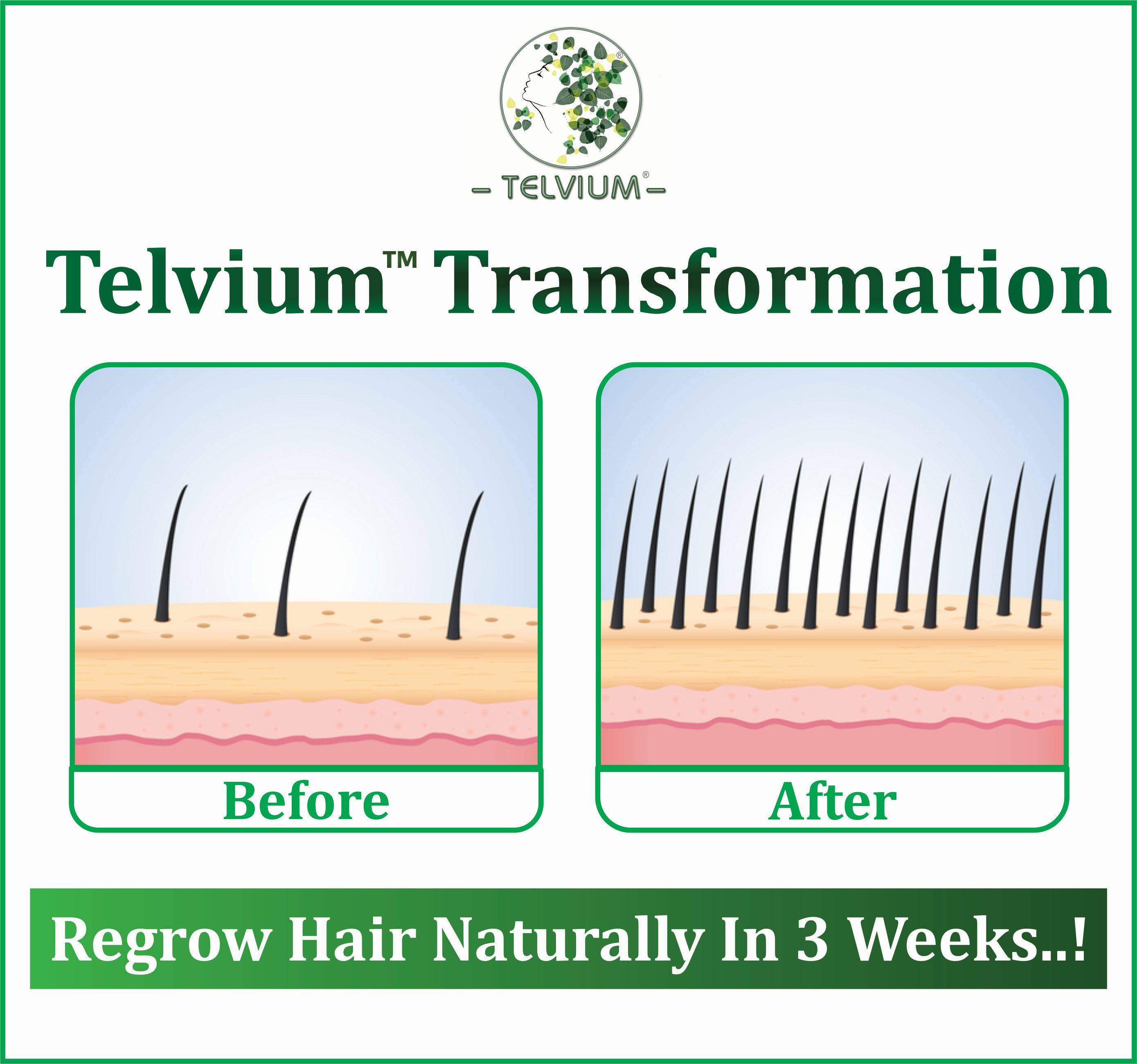 Regrow Lost Hair Naturally In 15 Minutes Donna Jenkins Medium