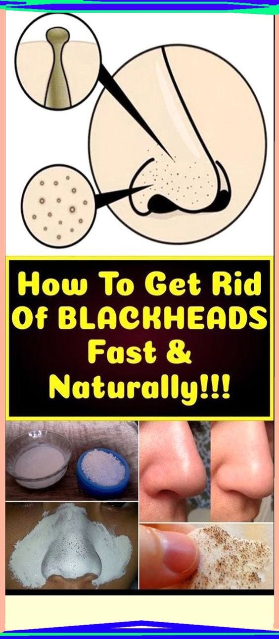 Remove Blackheads With One Simple And Effective Trick Mark Berte Medium