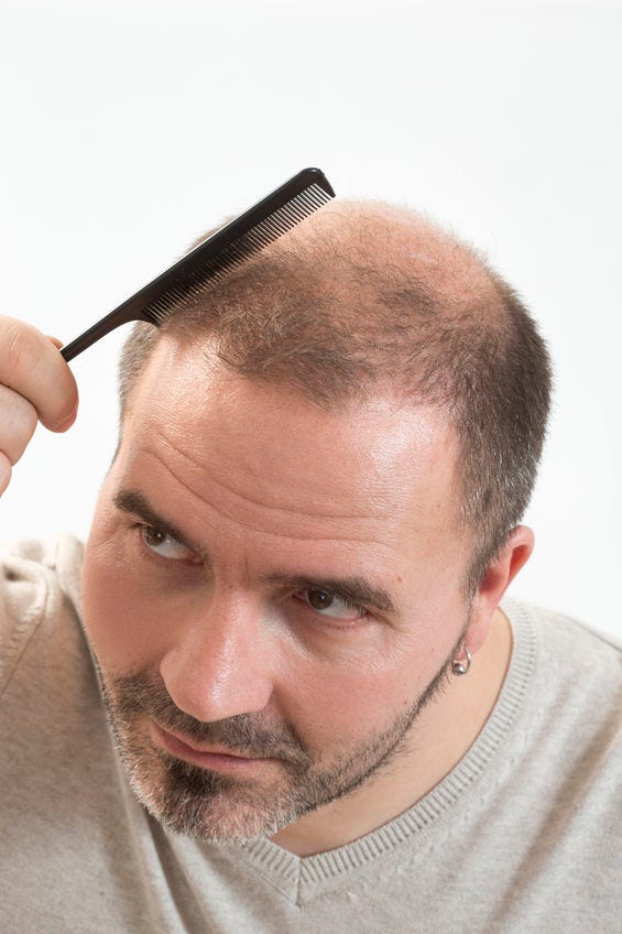 Haircuts For Men Going Bald Emma Kalman Medium
